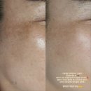 미백피부샵 이미지