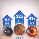 우리 동네 안경 이미지