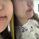 지비케어 이미지