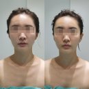 장유프라자 | 김해피부관리 고운빛깔에스테틱 김해장유점, 온다웨이브 후기