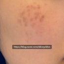 크림성형외과의원 이미지