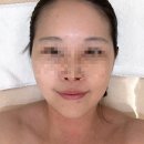 금령로106번길 | 용인 처인구 피부관리 에스테틱원아워 아프지 않고 확실한 웨딩 관리 /윤곽관리 후기