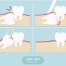 서울사랑니안녕치과의원 이미지