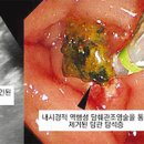 명치 통증 위치별 이유 (오른쪽, 왼쪽, 위아래, 누르면 통증) 이미지