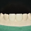 삼성치과기공소 이미지