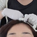 스킨N스칼프 이미지