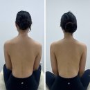 e바다 | 천안 불당동 바다관리 은율에스테틱 E.Y 숄더 윤곽관리, 테라노바 윤곽관리 리얼후기