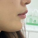 함희정성형외과의원 네이버블로그