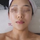 천궁장의 | 하대동 수기관리 강선뷰티동안연구소 윤곽관리 체험 후기