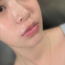 도란사민 부작용 캅셀 복용법 처방 기미 변화 효과 리얼 후기