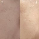 스토리샵 | 천안 신불당 피부샵 "스토리에스테틱" 스페셜 아로마 맞춤 페이스관리 리얼후기