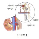 만성 신부전 (Chronic renal failure) 이미지