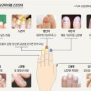 얼굴·손만 봐도 건강 보여요 이미지