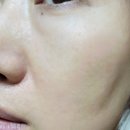 눈밑주름없애는방법 아이패치 추천 DNA 주름패치 후기