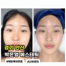 얼굴빛에스테틱웨딩신부관리 | 안산 피부관리[박은영 에스테틱]얼굴 승모 신부 웨딩케어 받은 후기