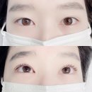 블링you