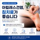 천안 청당동 발뒤꿈치 통증 아킬레스건염 침치료 후기 많은 한의원