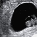 신세계병원산후조리원 이미지