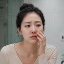 화도중기 | 지루성 피부염 코밑 붉은기 관리 루틴 최최최최종 (초기/중기/말기)