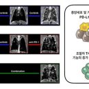 ALK 이미지