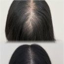 스테이 무아 이미지