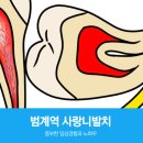 범계굿모닝치과의원 네이버블로그