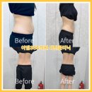 능곡서비스 이미지