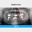 용인플란트치과의원 이미지