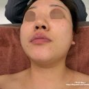 분당-203 | 분당 야탑 피부관리 : [ 빛나는지금 야탑점 ] 1회...효과가 좋았던 얼굴 윤곽 + 데콜테 관리 솔직후기