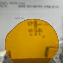 H 메디컬 | 송파안경 잠실안경 잠실새내안경 망막병증 증상 완화 칼자이스 메디컬 렌즈 맞춤 후기