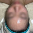 대구피부샵 노멀리즈에스테틱 창조경제단지 | 수부지 피부정밀진단, 물광퍼밍관리 후기