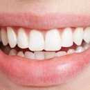 미소나래치과의원 이미지