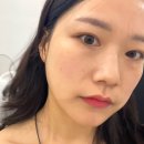 수성구리프팅 | 유아이에스테틱, 5세대 최신리프팅 리턴리프팅 관리 찐! 후기