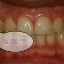 이사랑치과기공소 이미지