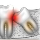 섬세한사랑니치과의원 이미지