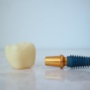 강원치과기공소 | 태장동치과, 선택의 첫 기준은 두려움에 대한 이해부터.