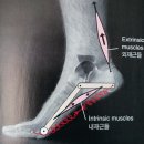 진천신라병원 | 진천신라병원 족저근막염 치료 후기 1편