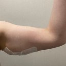 속편한 곽내과의원 | 상상 그대로의 팔뚝과 허벅지 만들기 서울 지방분해주사 다이어트 의원 1차 후기