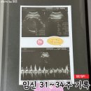 다가전잡화 | [임신일기] 임신 31~34주 기록, 경주 태교여행과 임신중독증 의심으로 응급진료 받다. (경주 토모노야...