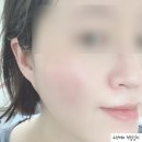 피엔씨유통(주) | [수분크림추천] 얼스노트 블랙보리 카밍 젤크림 순해서 좋아요 :D