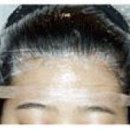 모델헤어라인 이미지