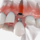 이특별한치과의원 이미지