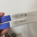 코끼리내과진단방사선과의원 | 난임 기간 나팔관 조영술 자궁 유착 제거 시험관 시술 비용 후기