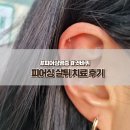 나은병원 | 피어싱 살튀 연고 약 병원 제거 없이 염증 나은 후기(귓바퀴)