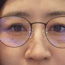 하늘비전안경콘택트 이미지