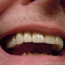 부천치과 더탑치과교정과치과의원 전문가의 손길을 느껴봐