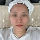 홍성군매안심센터 | 홍성 내포 피부관리샵 원뷰티, 문제성피부, 윤곽·안색개선까지 한 번에