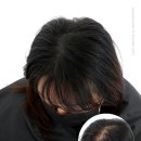 라이모플러스(LYMOPLUS) 이미지