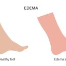 다리핏의원 이미지