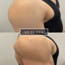 바이칼휘트니스 이미지